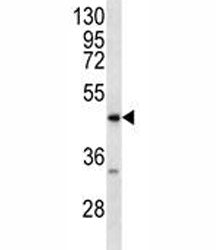 RAGE Antibody