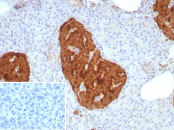 NSE Antibody / Neuron Specific Enolase