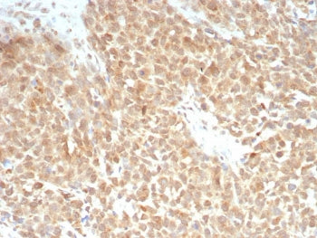 XCT Antibody / SLC7A11