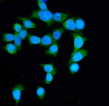 DIAPH1 Antibody / Diaphanous Homolog 1