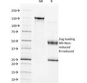 SDS-PAGE analysis of purified, BSA-free TIMP1 antibody (clone 2A5) as confirmation of integrity and