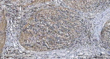 STIL Antibody / SIL / SCL-interrupting locus protein