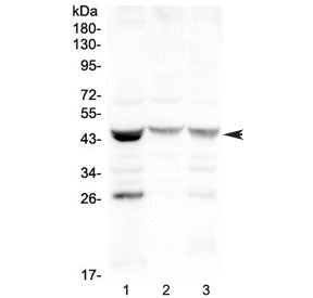 SFTPB Antibody / Pulmonary surfactant-associated protein B