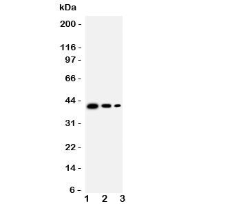 TRAM2 Antibody