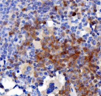 IHC staining of FFPE mouse spleen with Interleukin 3 antibody. HIER: boil tissue sections in pH8 EDT