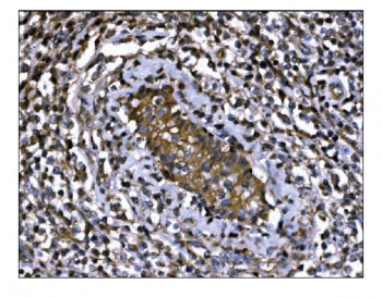 IGF2R Antibody / M6PR