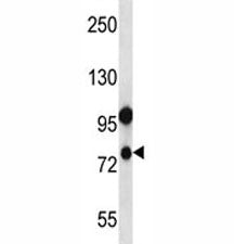 NLRP10 antibody western blot analysis in human placenta tissue lysate.