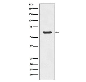ASNS Antibody / Asparagine Synthetase