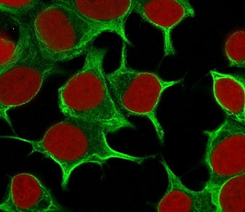 KRT19 Antibody / Cytokeratin 19
