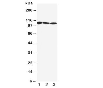 SERCA1 ATPase Antibody