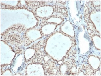 IHC staining of FFPE human thyroid tissue with ZHX3 antibody (clone PCRP-ZHX3-1G3)at 2ug/ml. HIER: b