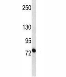 ABCB10 Antibody