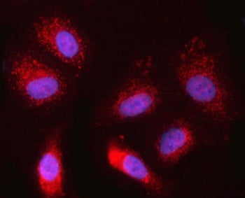 NDOR1 Antibody / NADPH-dependent diflavin oxidoreductase 1 / NR1