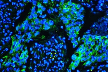 Caveolin-1 Antibody