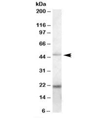 TXNDC4 Antibody