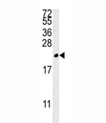 TREM2 Antibody