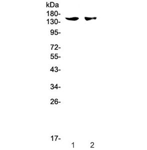 Western blot testing of 1) mouse spleen and 2) mouse thymus tissue with CD11c antibody at 0.5ug/ml.