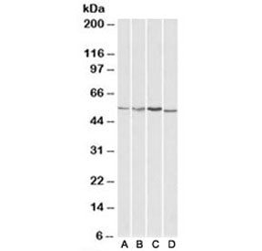 AKT3 Antibody