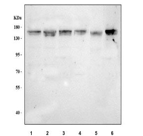 PPP1R13B Antibody / ASPP1