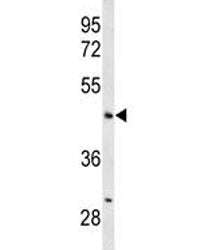 Western blot analysis of ANGPTL4 antibody and mouse liver tissue lysate. Predicted molecular weight: