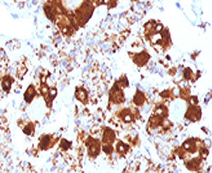 CLIP Antibody / ACTH