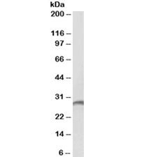 Proteinase 3 Antibody / PRTN3