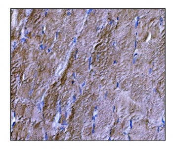 IHC staining of FFPE human skeletal muscle tissue with DYSF antibody. HIER: boil tissue sections in