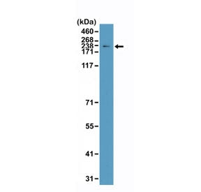 Western blot testing of human HeLa cell lysate with recombinant Topoisomerase II alpha antibody at 1