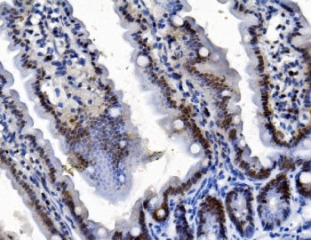 Pycard Antibody / Tms1 / mAsc