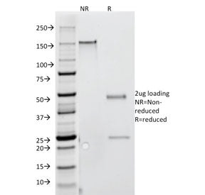 Interferon gamma Antibody / IFNG