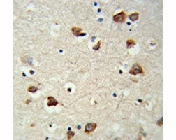S6K2 Antibody