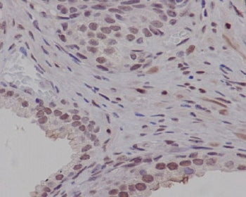 PIM1 Antibody