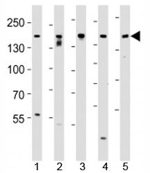 Tuberin Antibody (TSC2)