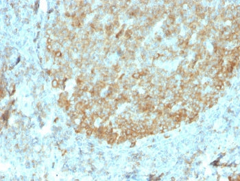 MALT1 Antibody