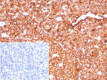 CD45RA Antibody (Leukocyte marker)