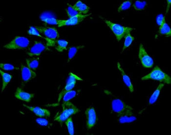 INHA Antibody / Inhibin alpha