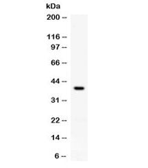 Western blot testing of rat brain lysate with RANKL antibody at 0.5ug/ml. Expected molecular weight: