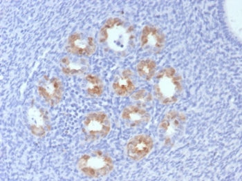 p16INK4a Antibody / CDKN2A