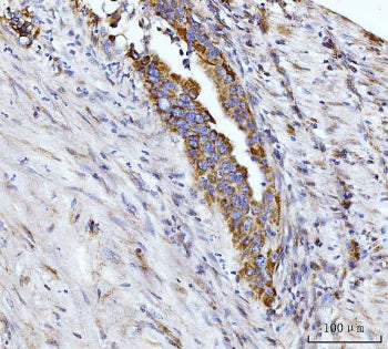 Glutaminase Antibody / GLS