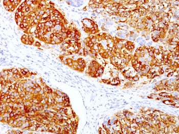 MART-1 / Melan-A Antibody
