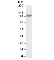 Western blot testing of A431 lysate with TRAP2 antibody at 0.03 ug/ml. Predicted/observed molecular