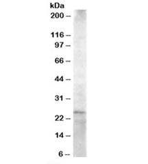 HIP2 Antibody