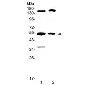GCK Antibody / Glucokinase