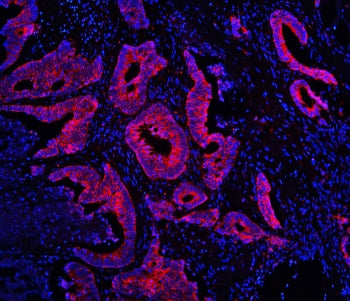 TDRD3 Antibody