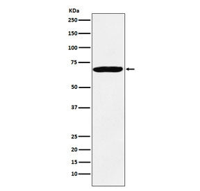 IGF2BP3 Antibody