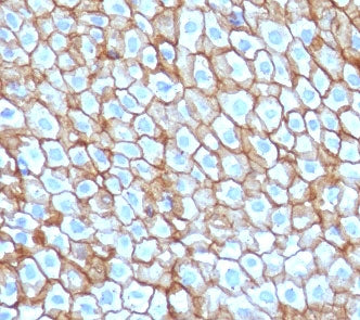 Desmoglein 3 Antibody / DSG3