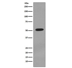 KRT7 Antibody / Cytokeratin 7