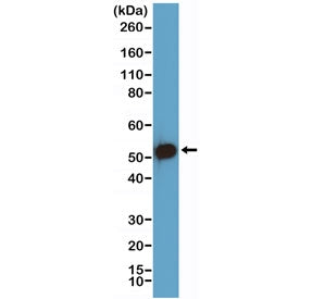 p53 Antibody / TP53