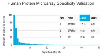 GTF2IRD2 Antibody / GTF2IRD2 alpha