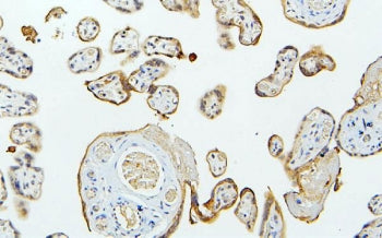 MID1 Antibody